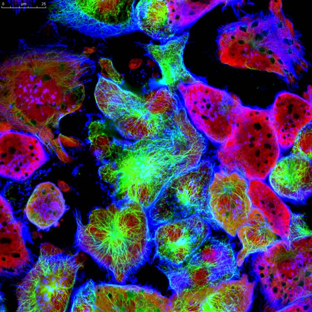 Colourful cancer cells