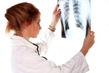 Doctor holding X-ray