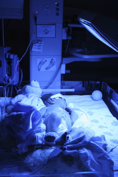 A baby in an incubator