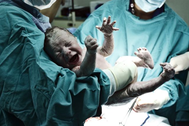 A new born baby held by doctors: copyright www.istockphoto.com 12676907